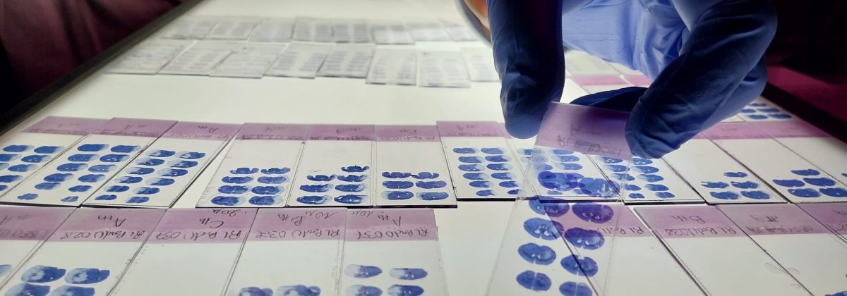 Coupes histologiques marquées à la thionine